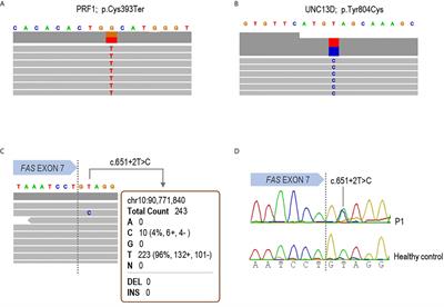 Next Generation Sequencing for Detecting Somatic FAS Mutations in Patients With Autoimmune Lymphoproliferative Syndrome